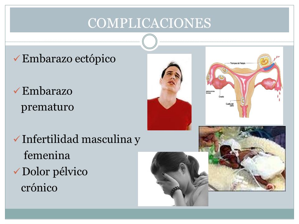 Si duele el cóccix cuando estás o estás sobre la espalda